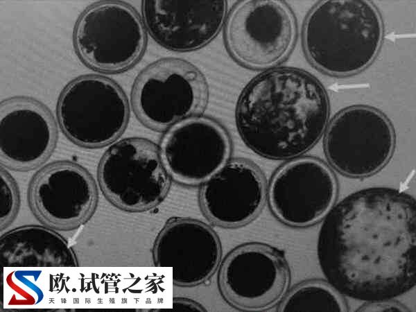 桑葚胚胎移植成功率多高(图2)