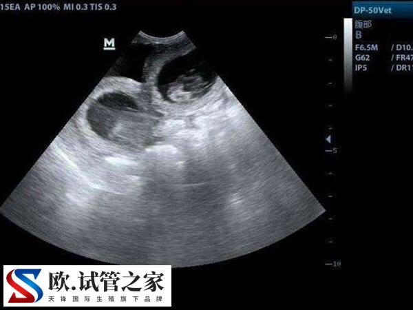 冻胚移植长内膜期间能不能热敷(图2)