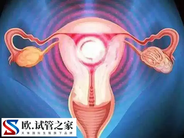 双子宫做试管婴儿有无影响