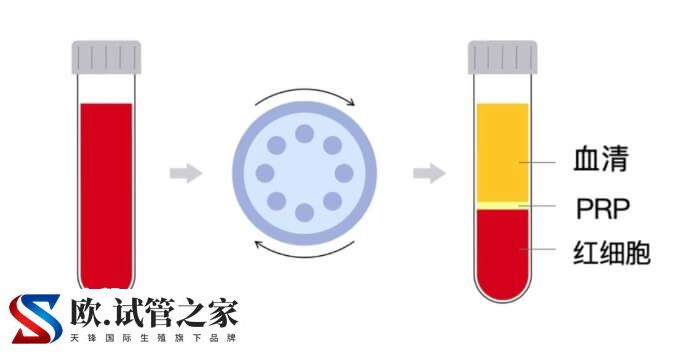 反复种植失败做宫腔灌注用富血小板血浆(PRP)还是环孢素？(图2)