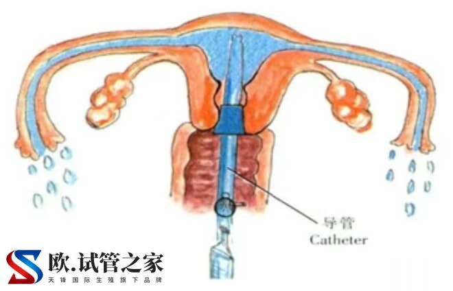 富血小板血浆PRP宫腔灌注后需注意3-7天内禁止同房吗？